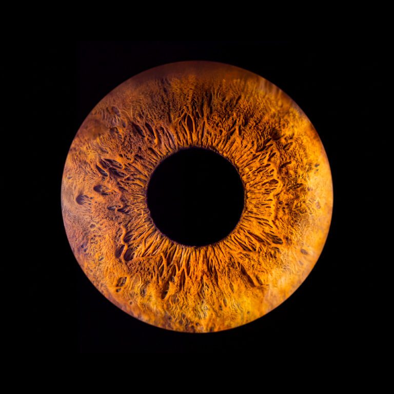 Ludivine iris marron oeil